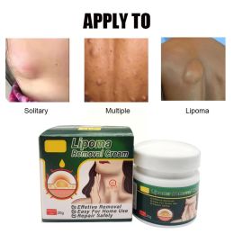 Chinese Medicine Multiple Anti-tumor Lipoma Pain Cream (Option: 43g)